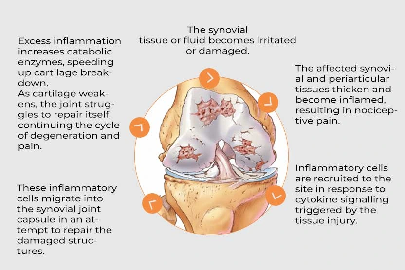 The synovial pain cycle